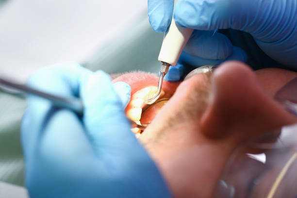 Best Pediatric Emergency Dentist in Empire, CA