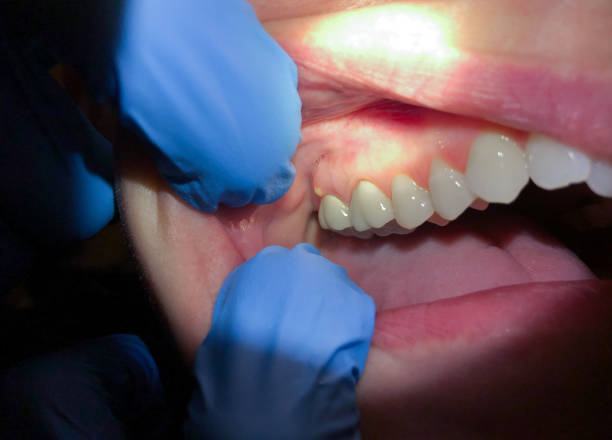 Best Emergency Broken Tooth Repair in Empire, CA