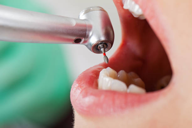 Best Same-Day Emergency Dentist in Empire, CA